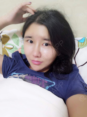 脂肪填充后下巴长痘痘