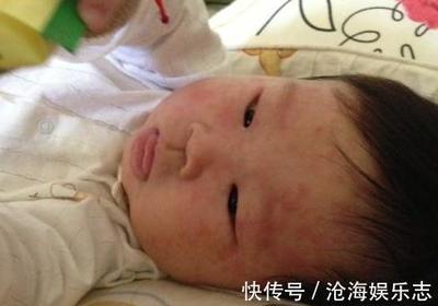 宝宝单纯发烧没有其他症状