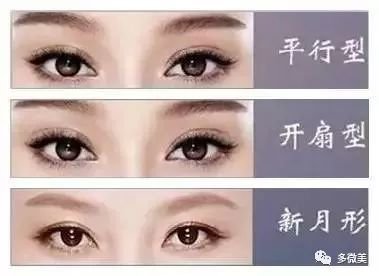 想做双眼皮