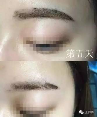 半永久眉毛需要补色吗