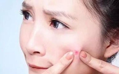 28了还长痘痘