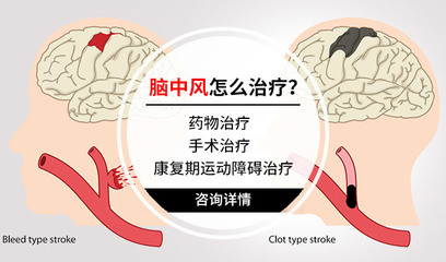 蛛网膜下腔少量出血怎么治疗