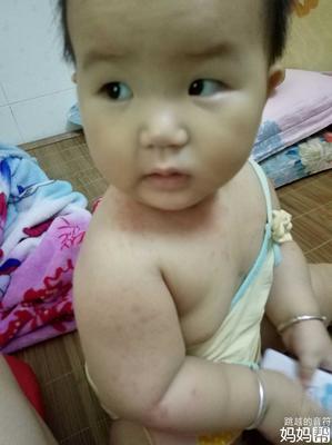 为什么宝宝一吃母乳就拉肚子