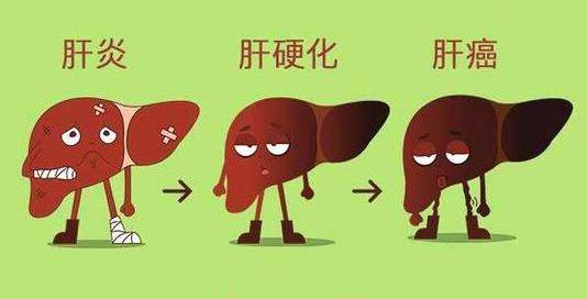 肝炎怎么治疗最好的方法