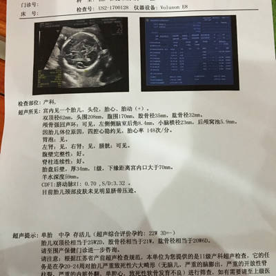 宝宝做核磁共振