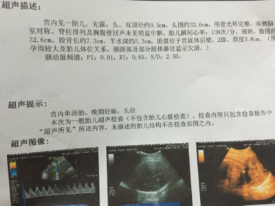 胎儿估算体重