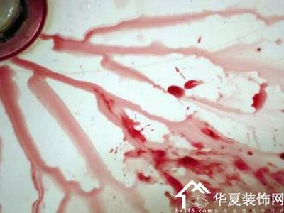 梦见别人流血了，梦境背后的深层含义与解析