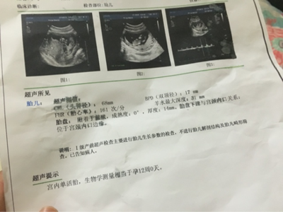 怀孕12周见红了有事吗