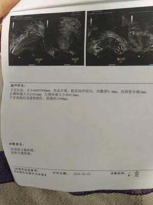 宫颈囊肿可以怀孕吗