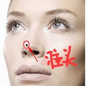 右眼睫毛根内长痣命运