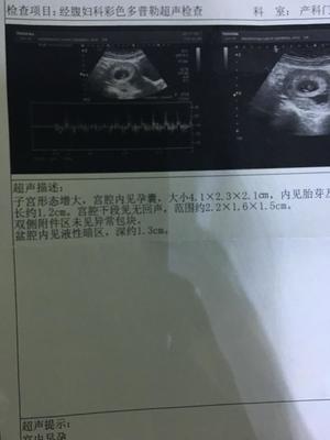 怀孕4周会恶心吗