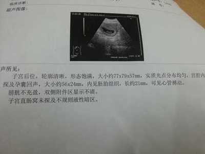 怀孕2个月最准看男女