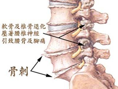 腰椎响是怎么回事