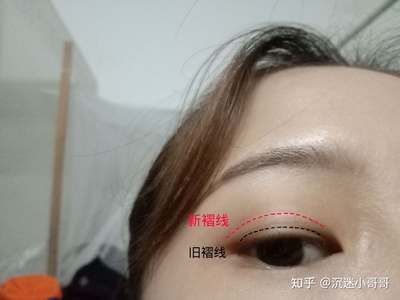 怎样贴双眼皮贴