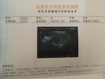 怀孕会二次发育吗