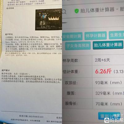 胎儿身高计算器
