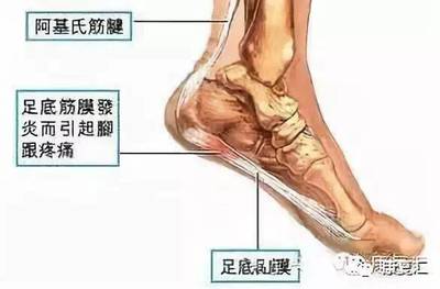 脚底板中间疼是怎么回事