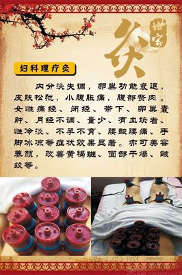 开艾灸馆需要什么手续