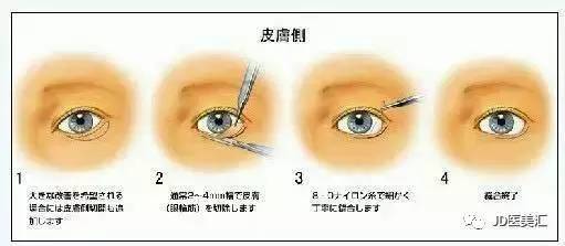 开眼角下至