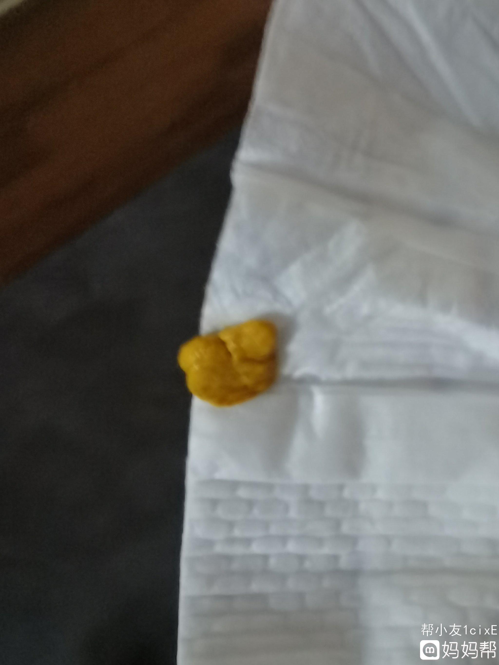 宝宝大便费劲怎么办