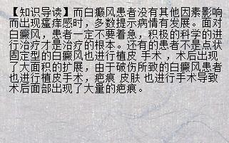 梦见自己的病