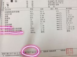 总胆固醇偏高怎么治疗