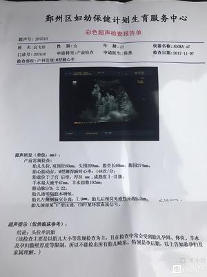 胎儿颅脑超声