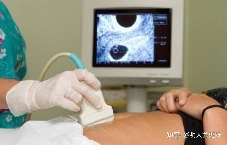 怀孕一个月如何流产