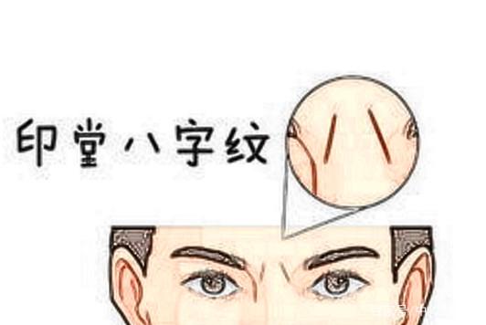 眉心八字纹