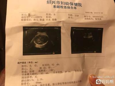 怀孕做彩超需要空腹吗