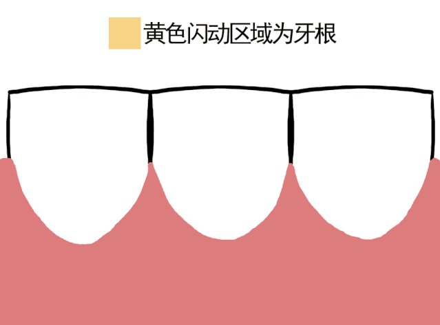 牙齿最多后移多少