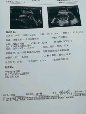 胎儿单独做心脏彩超多少钱