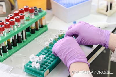 亲子鉴定需要多久