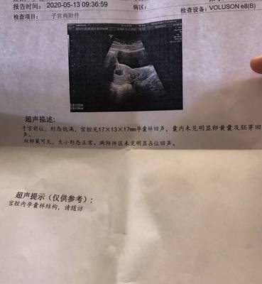 怀孕会二次发育吗