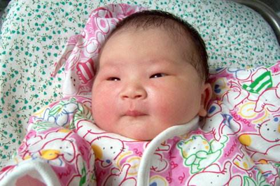 新生儿肚子圆鼓鼓的