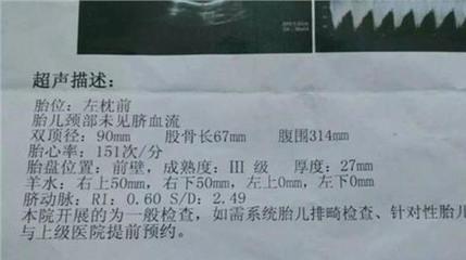 怀孕36周胎动减少正常吗