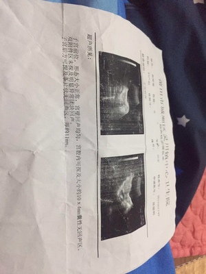 怀孕着床晚是什么意思