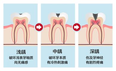 胃口高是怎么回事