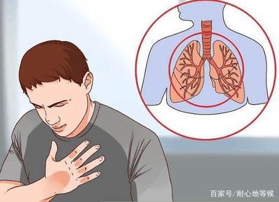 早晨起床咳嗽痰多是怎么回事