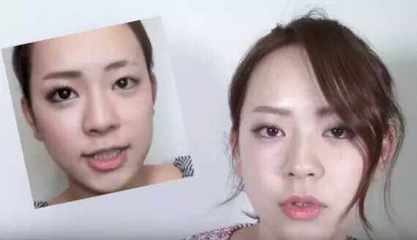 整容双眼皮的危害
