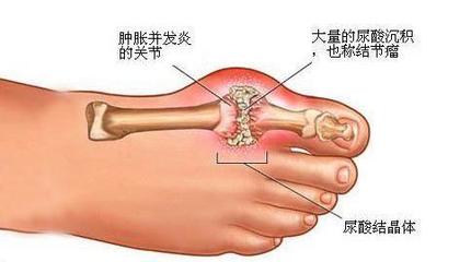 脚面关节疼是怎么回事