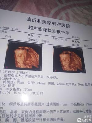 孕27周是几个月