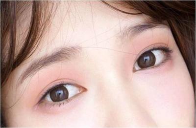 桃花眼必须是双眼皮吗