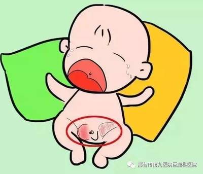 新生儿疝气