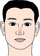 鼻头红面相征兆