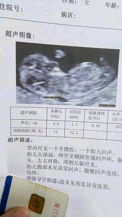 1个月流产