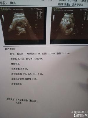 足月胎儿股骨长标准