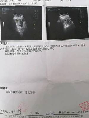 怀孕47天没有胎心胎芽正常吗
