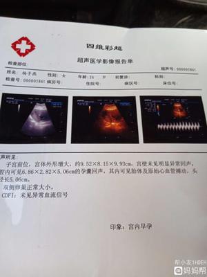 四维彩超几个月最合适