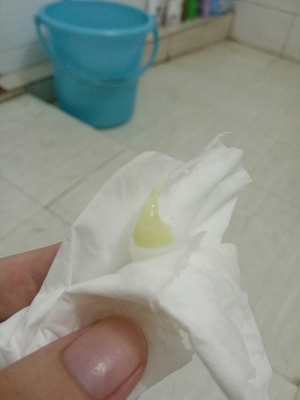 白带有腥味是怎么回事